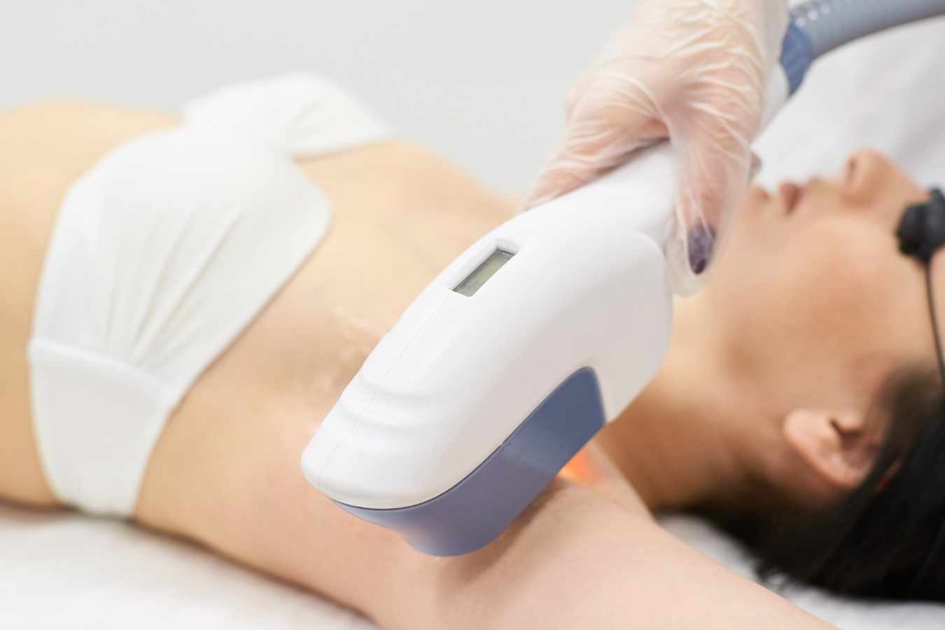Laser Hair Removal 