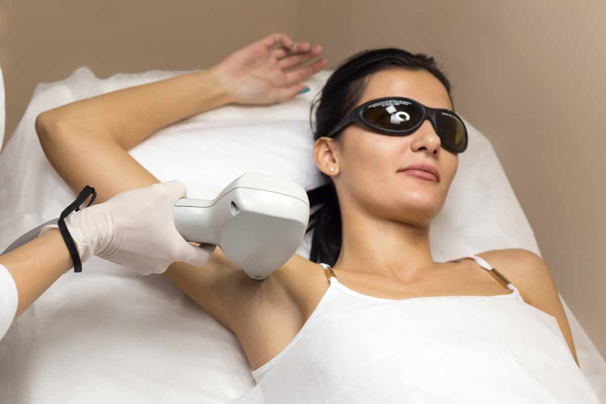 Underarm laser hair removal