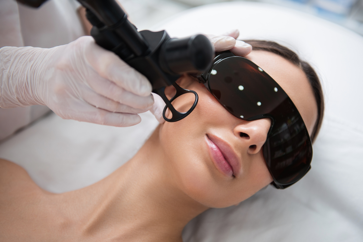 Laser skin rejuvenation