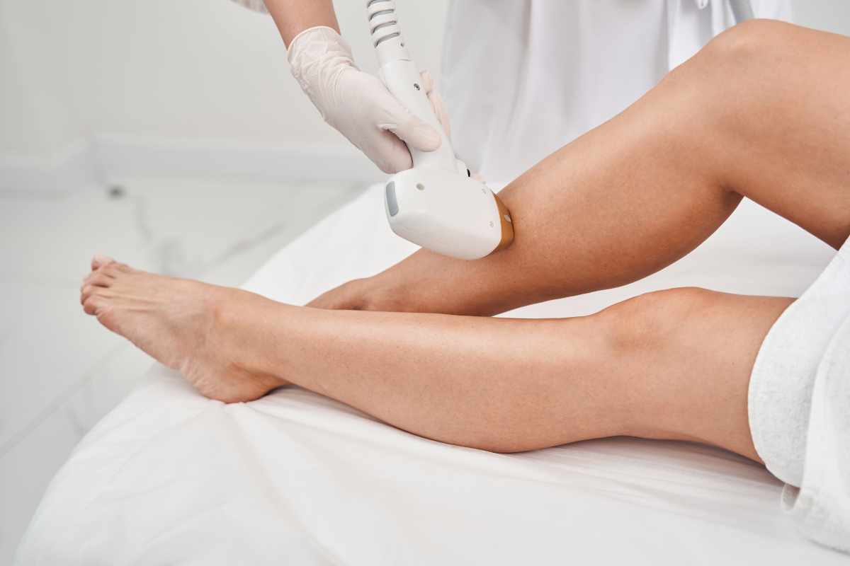 Leg laser hair removal