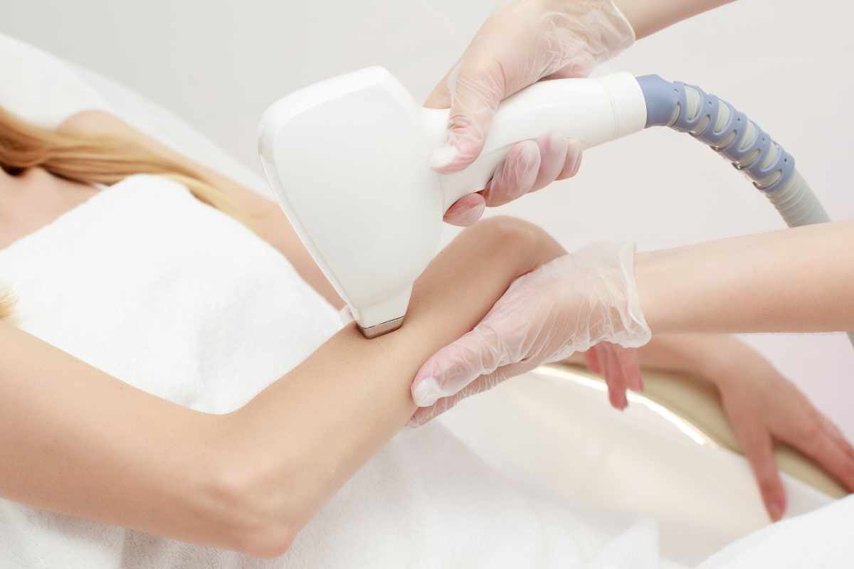 Laser hair removal
