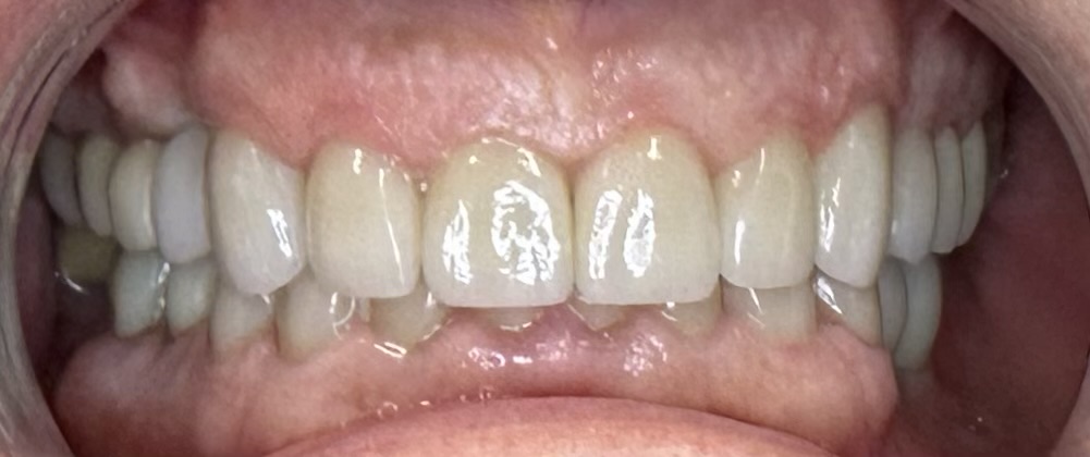 After Image