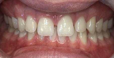 Before Image