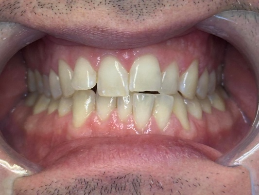 Before Image