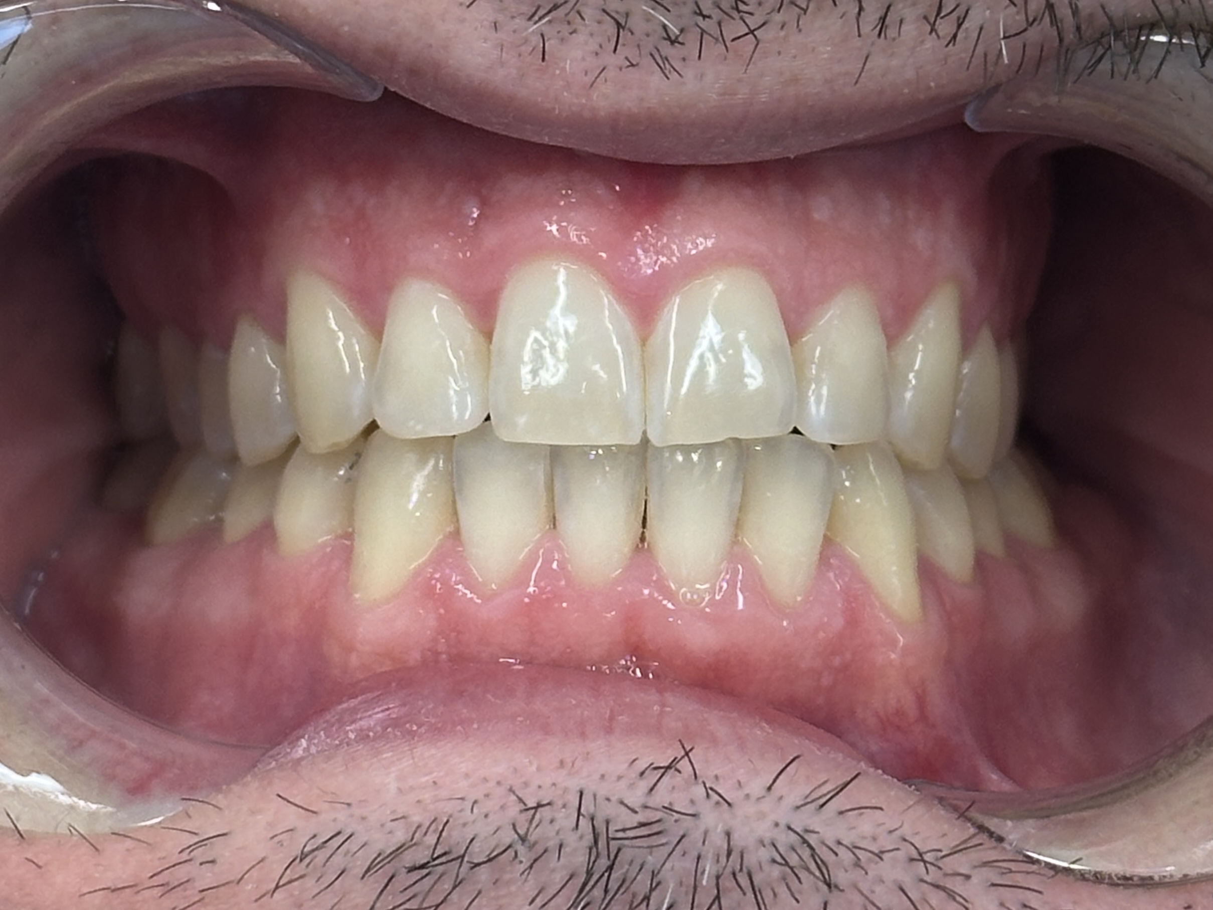 After Image