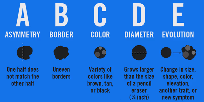ABCDE's of Melanoma | Skin Cancer And Reconstructive Surgery Center