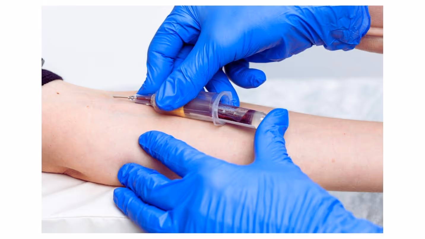 A person injecting a blood sampleAI-generated content may be incorrect.