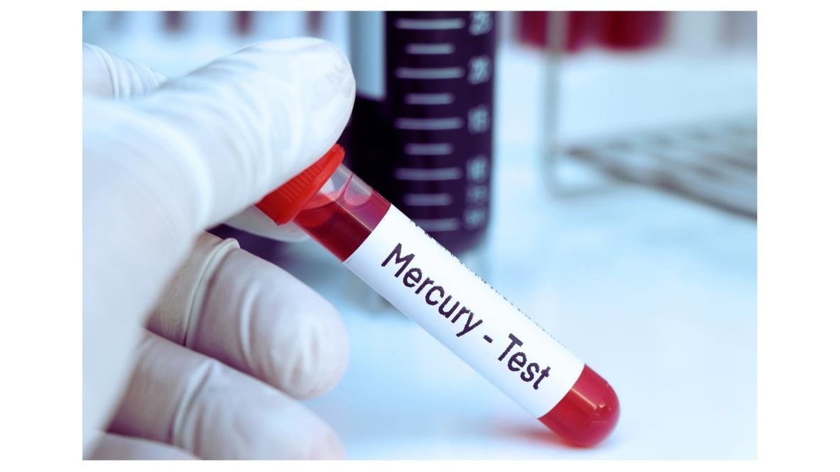 A hand holding a test tube with a labelAI-generated content may be incorrect.