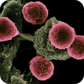 Whole Body Cancer Screening