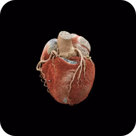 Advanced Cardiac Imaging