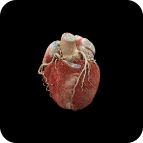 Advanced Cardiac Imaging