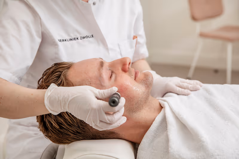 Hoe ziet het behandelplan met microneedling bij acnelittekens eruit?