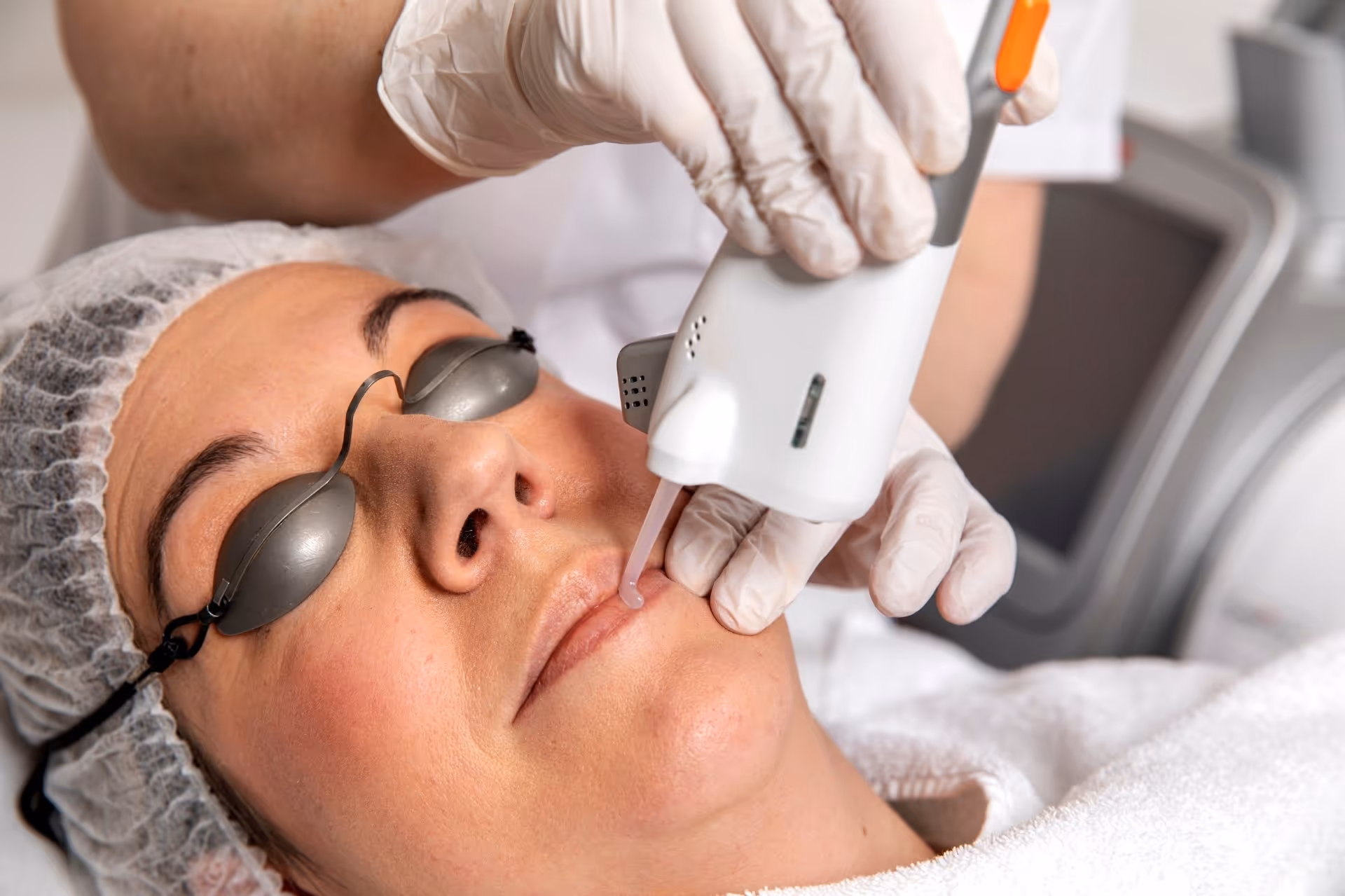 Vaatlaser bij een venous lake