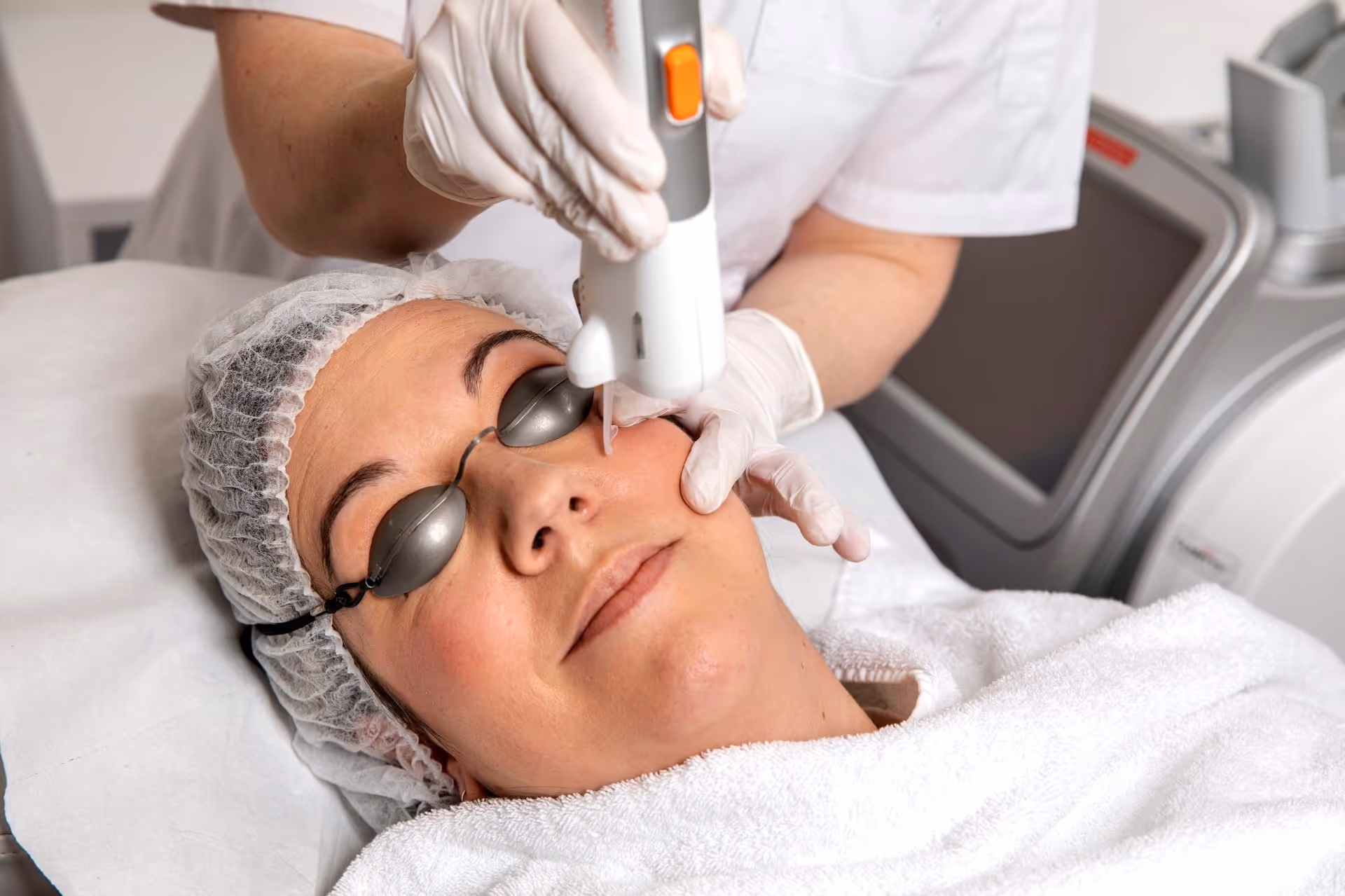 Vaatlaser bij spider naevus