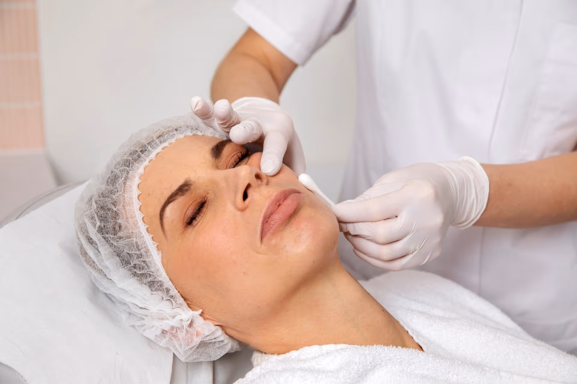 TCA peeling voor huidverjonging