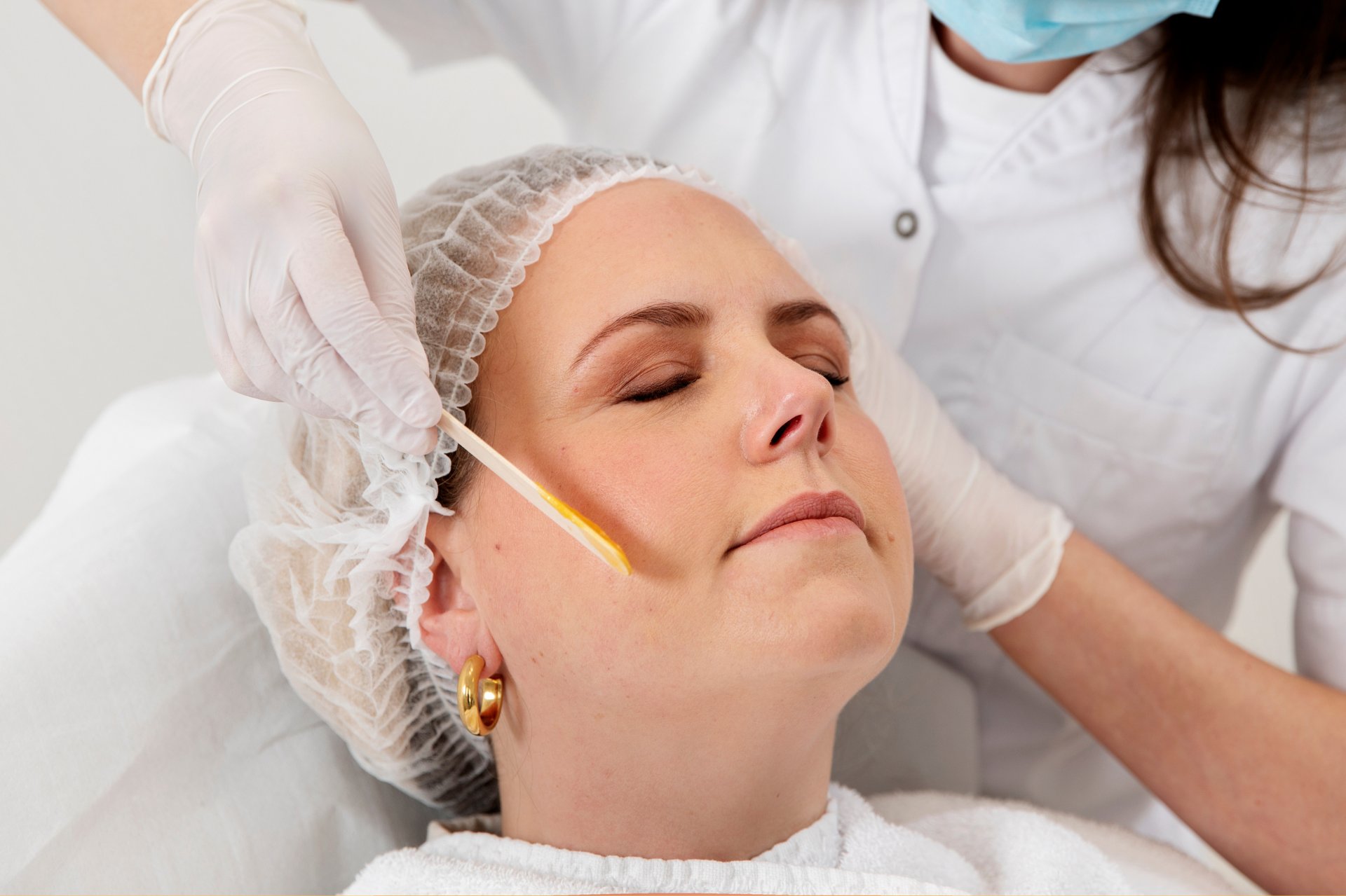 Peeling bij Laserkliniek Zwolle
