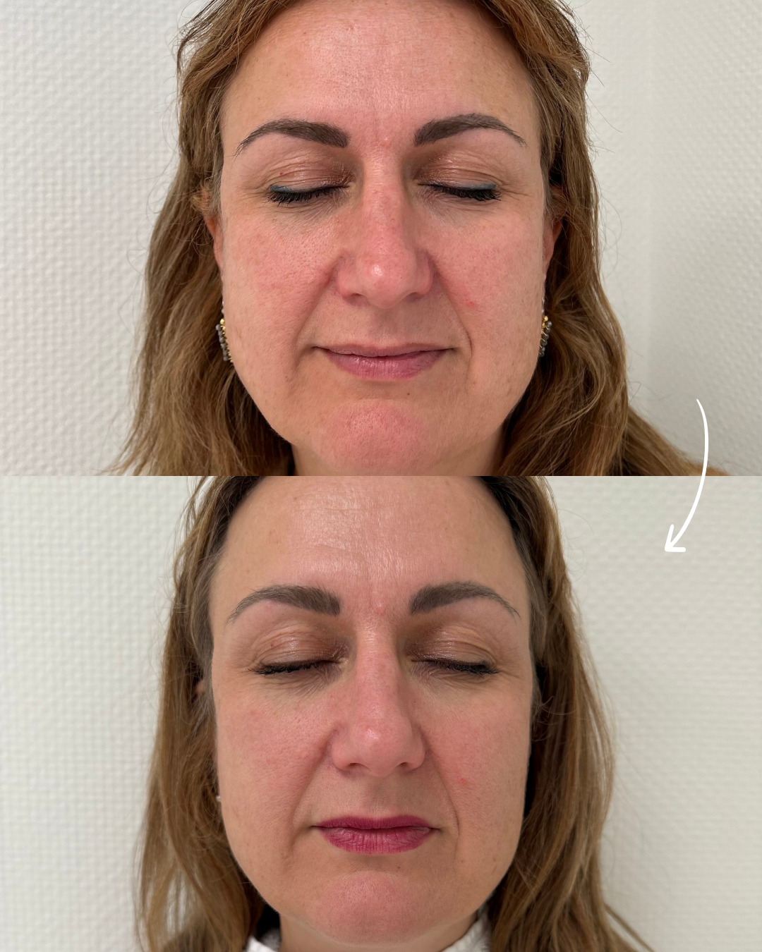 Het effect van skincare op huidverjonging