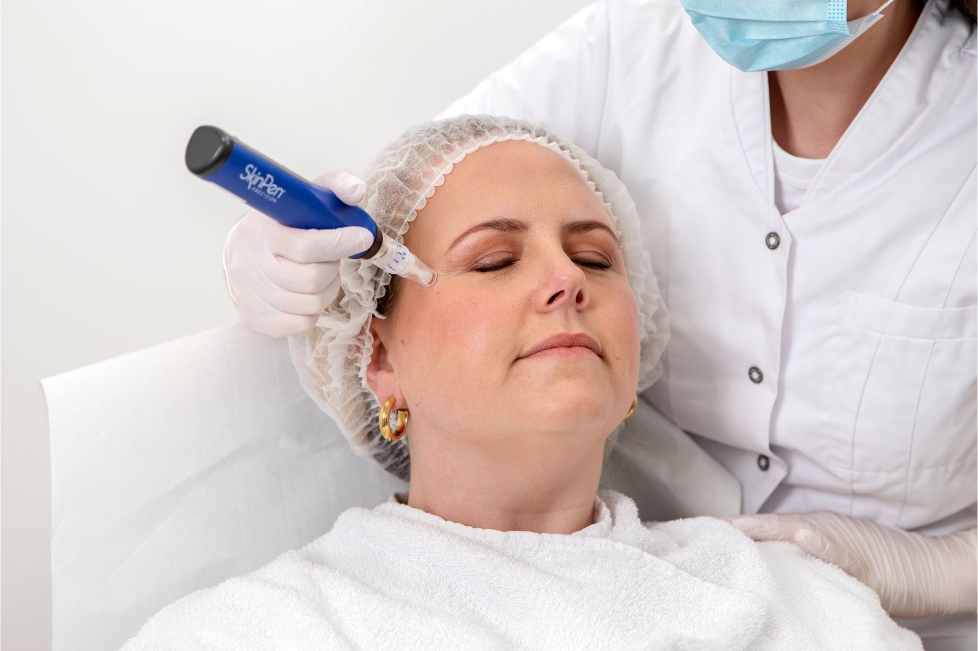 Microneedling bij behandeling van littekens