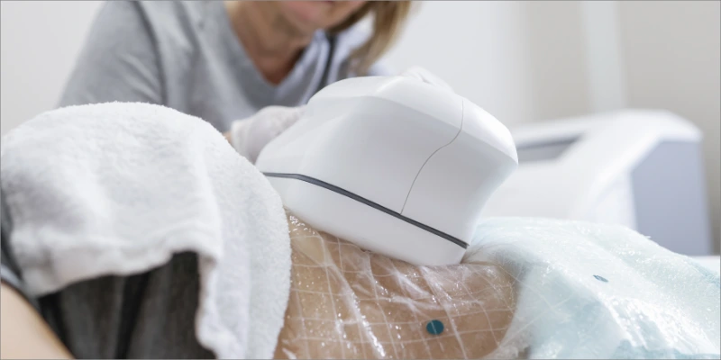 Frau nutzt ein medizinisches Gerät zur Hautbehandlung auf dem Bauch mit einem abgedeckten, markierten Bereich.