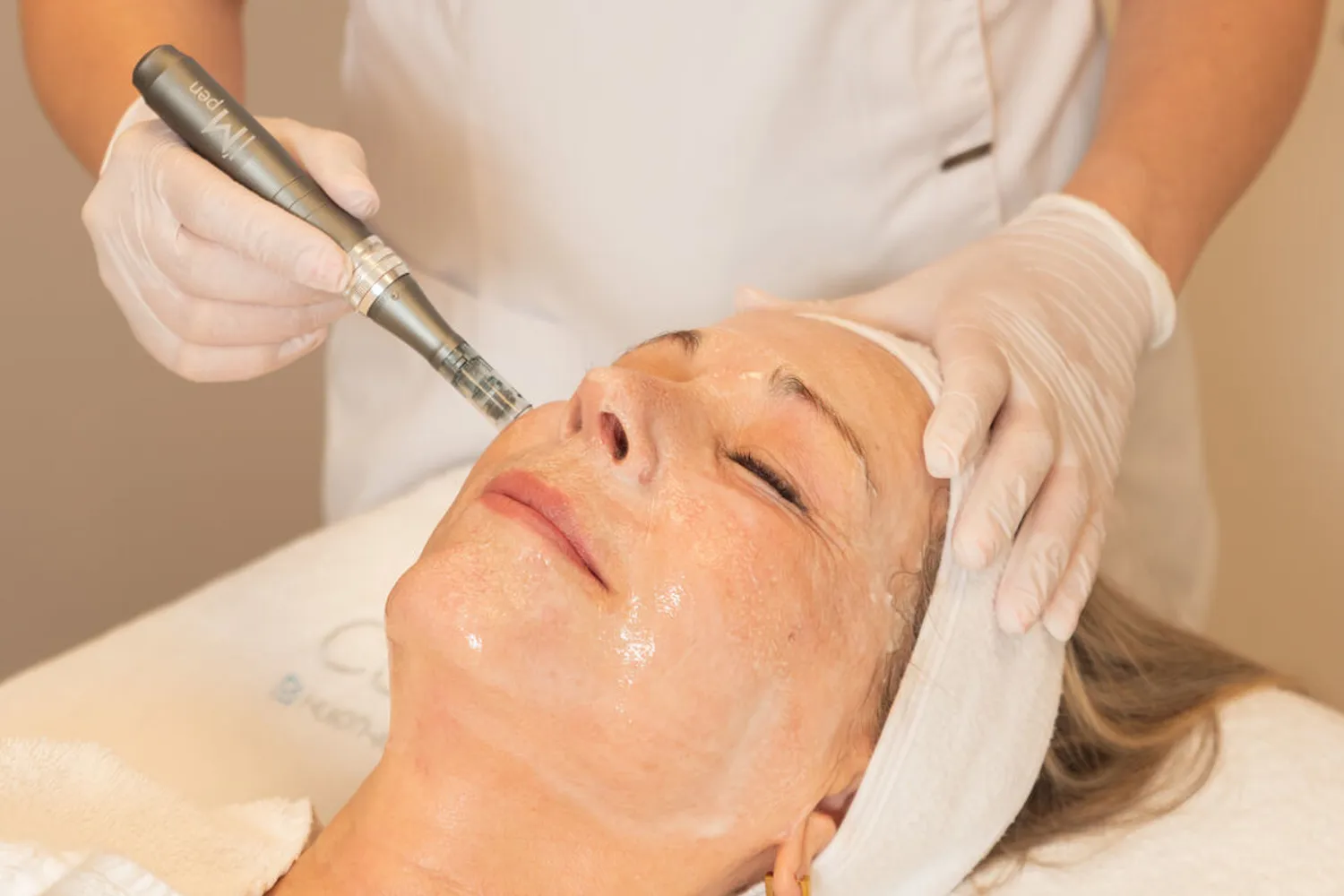 Frau erhält eine mikronadelnde Gesichtsbehandlung mit einem kosmetischen Gerät, während sie entspannt mit geschlossenen Augen liegt.