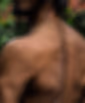Male patient back examination during comprehensive health assessment at Mar Max Medical