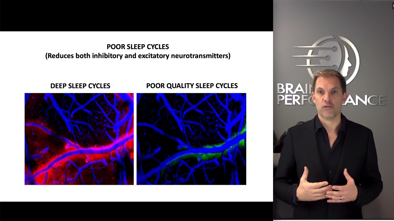 Quick EEG Brain Map Overview 4K