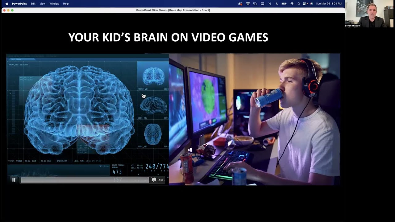 Your Kid's Brain on Video Games