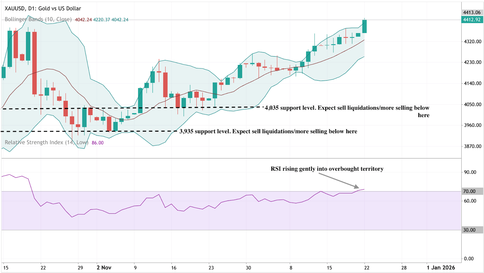  A daily candlestick chart of XAUUSD (Gold vs US Dollar) with Bollinger Bands applied.