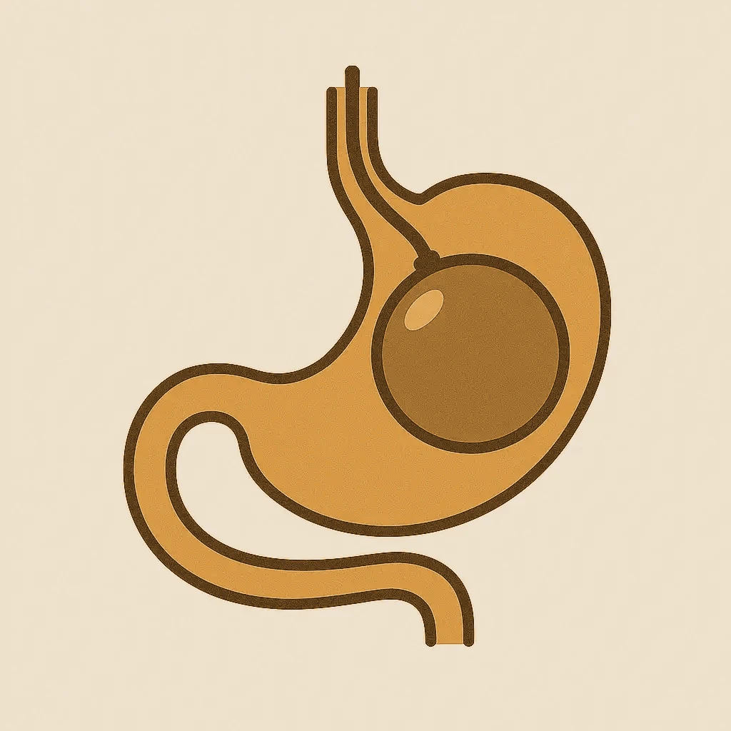 Gastric balloon