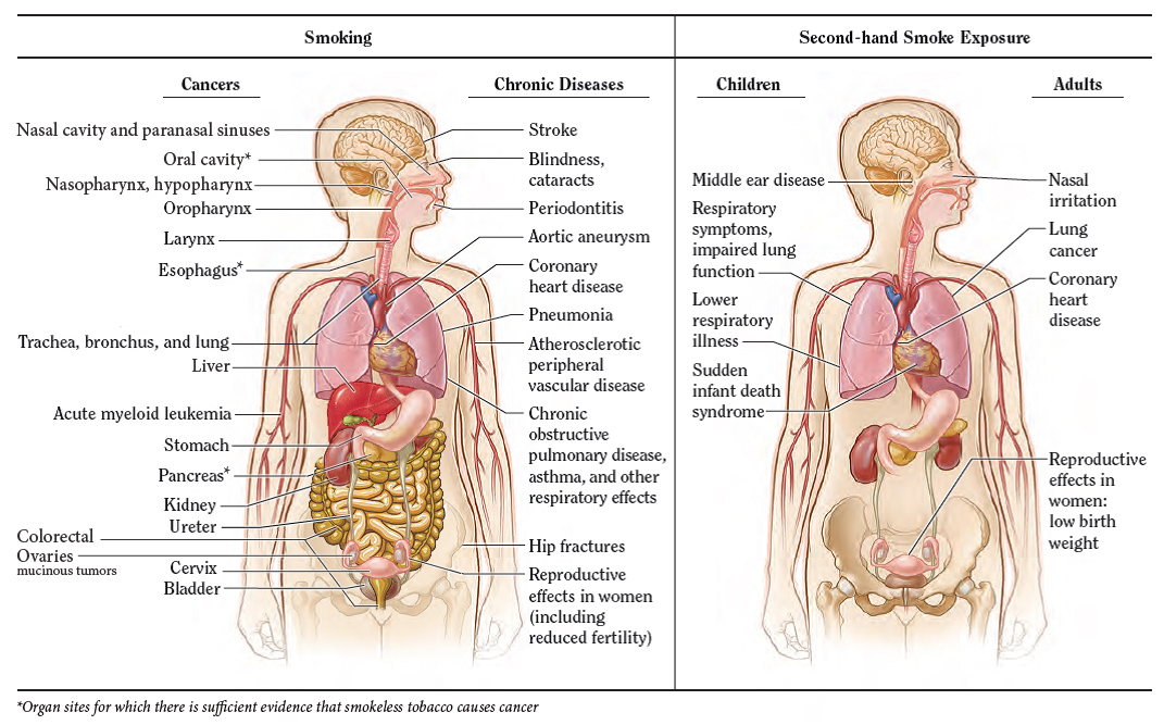 consequences-tobacco-second-hand-smoke