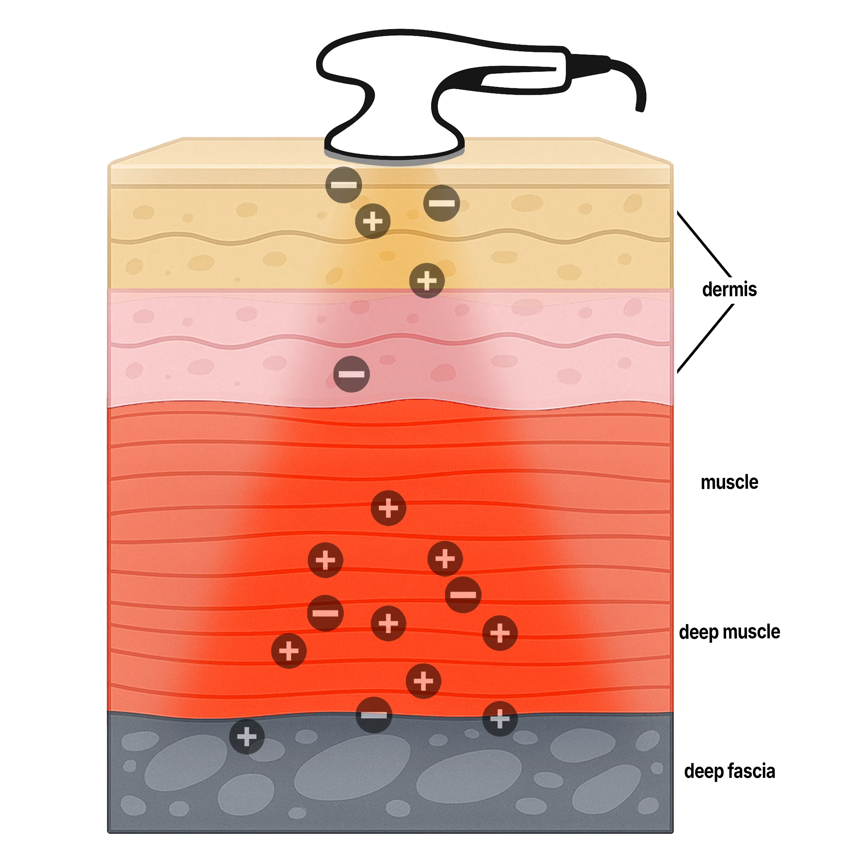 A visual diagram of capacitive mode's local thermal effect.