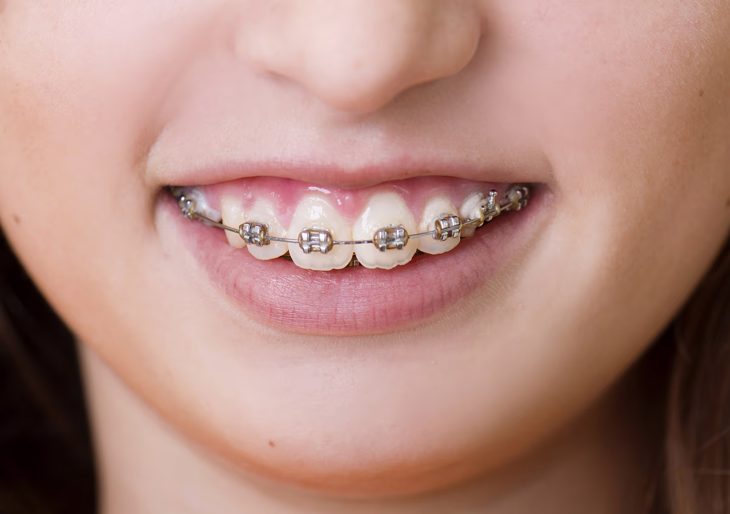 Illustration: orthodontics