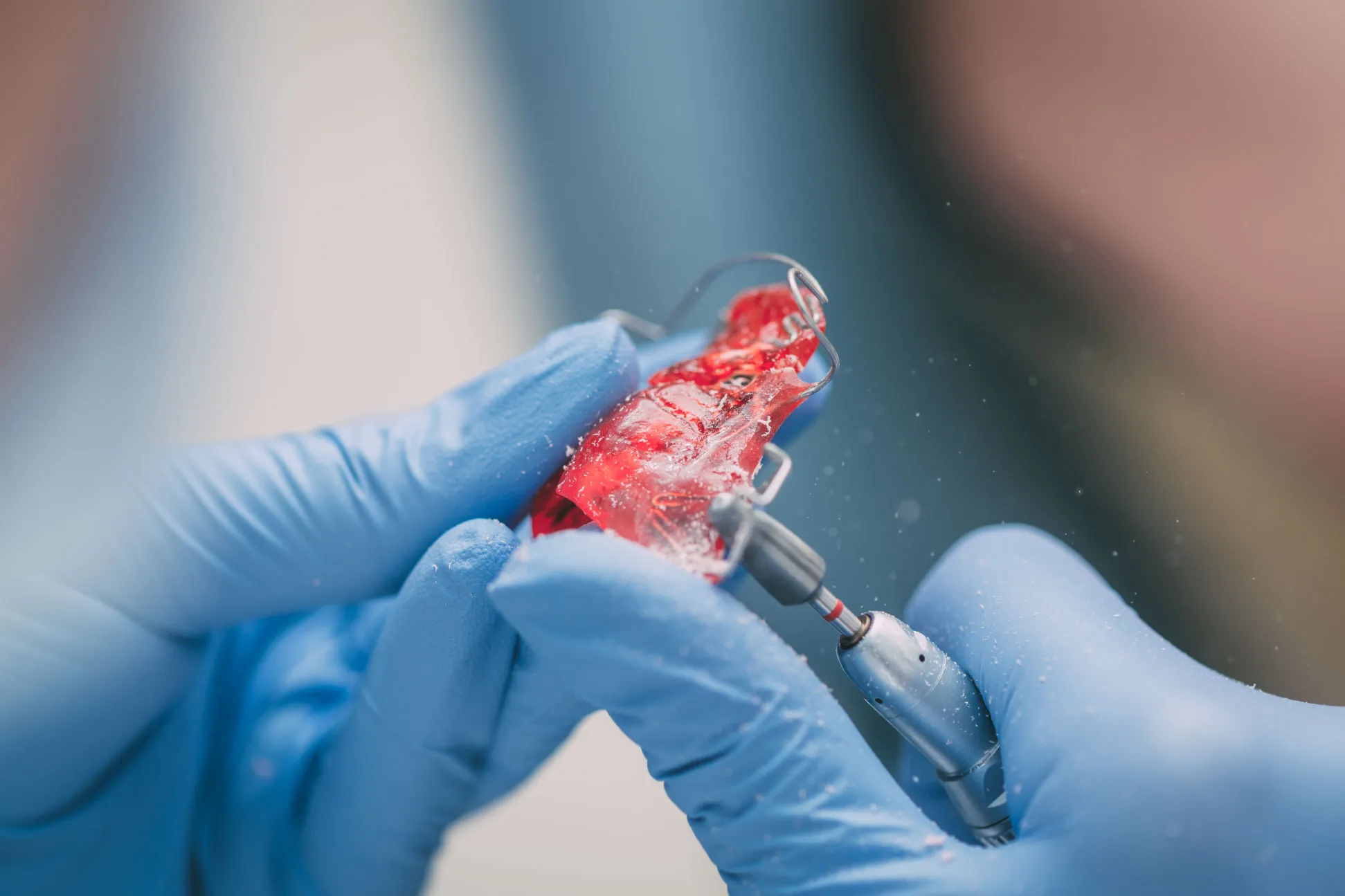 mobile-orthodontic-appliance