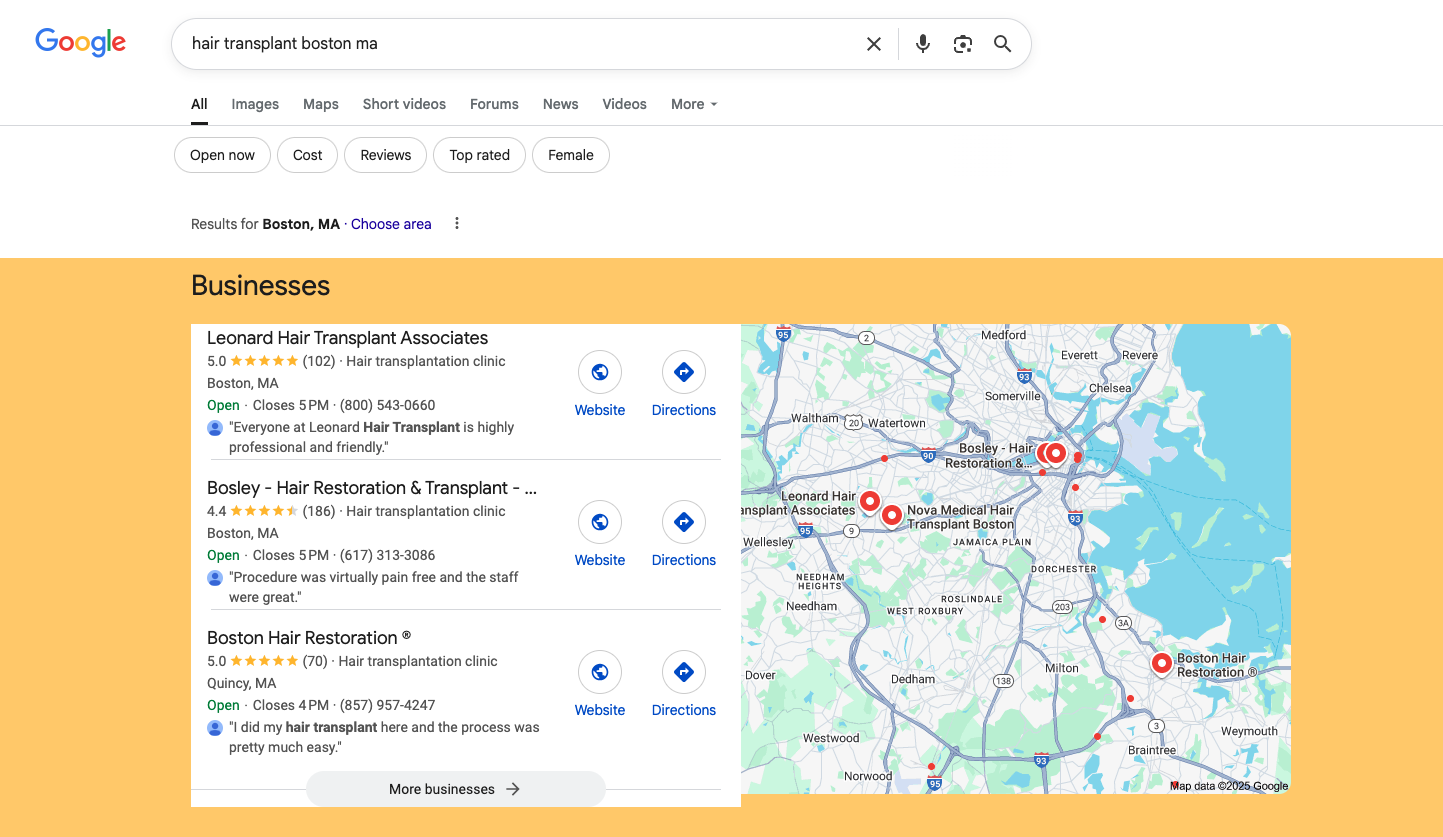Google AI Overview highlighting hair regeneration options in Boston and citing Boston Hair Restoration, with before-and-after image on the right.