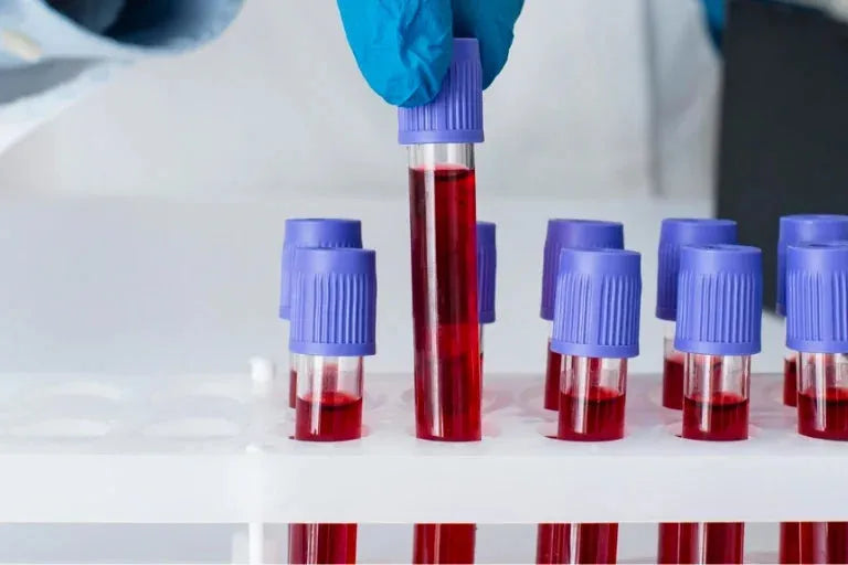 A person in blue gloves is holding a pipe with red liquid