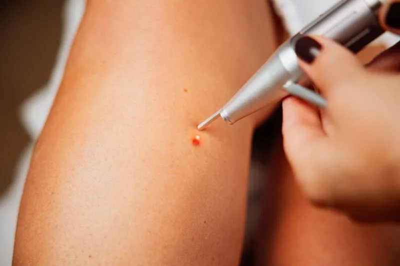 Medermis - služby estetickej a korektívnej dermatológie