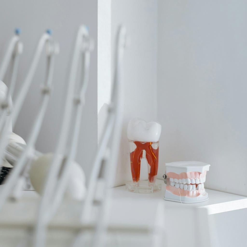 Dental root anatomy model and orthodontic teeth model displayed in modern dental clinic — iHeart Smiles Tweed Heads