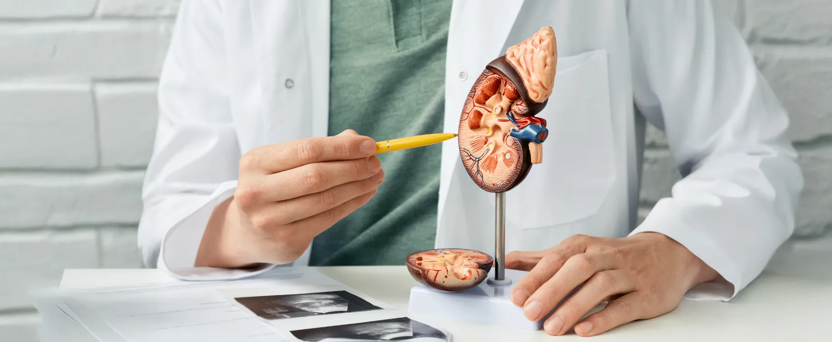 Doctor in white coat pointing at anatomical kidney model with a yellow pen on a desk with medical images.
