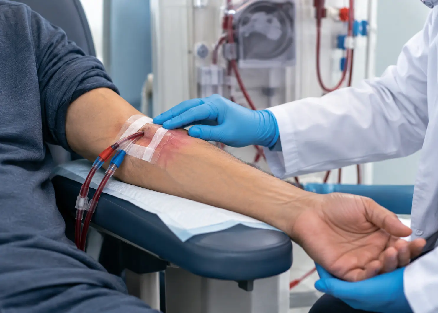 Warning signs of a dialysis access infection