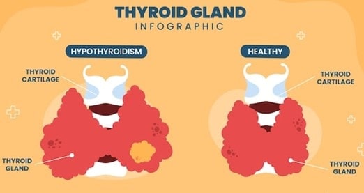 What Causes Hypothyroidism During Pregnancy?
