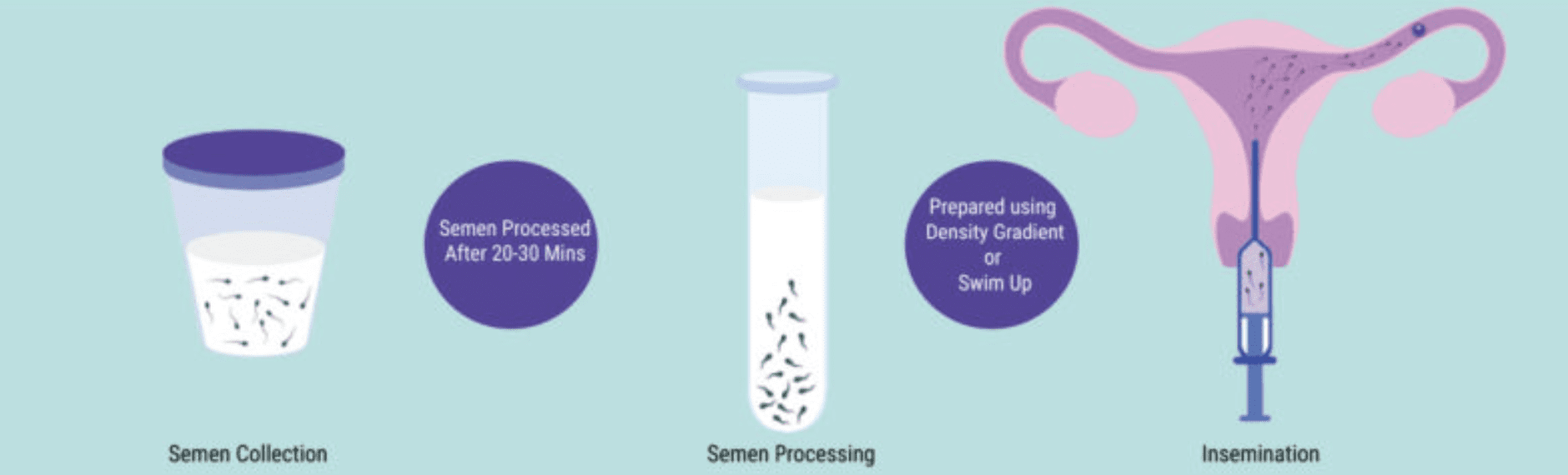 Timing of the insemination procedure
