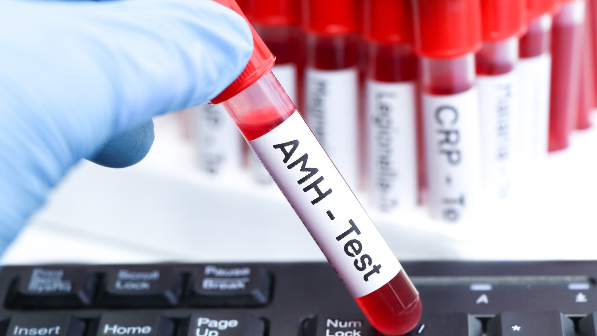 What Is the AMH Test and Why It Matters for Fertility