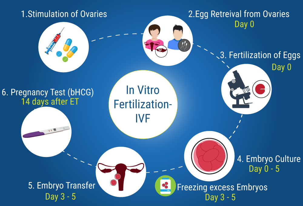 IVF Treatment Step-by-Step: Egg Retrieval, ICSI, Embryo Culture, and Embryo Transfer