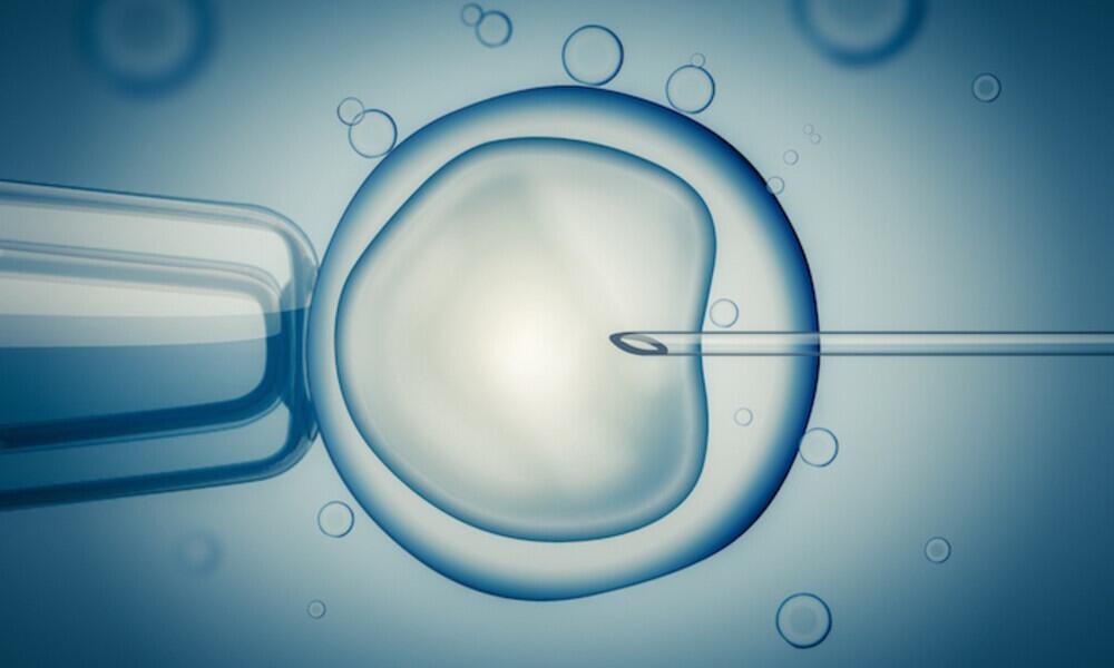 How In Vitro Fertilization (IVF) Fits into ART