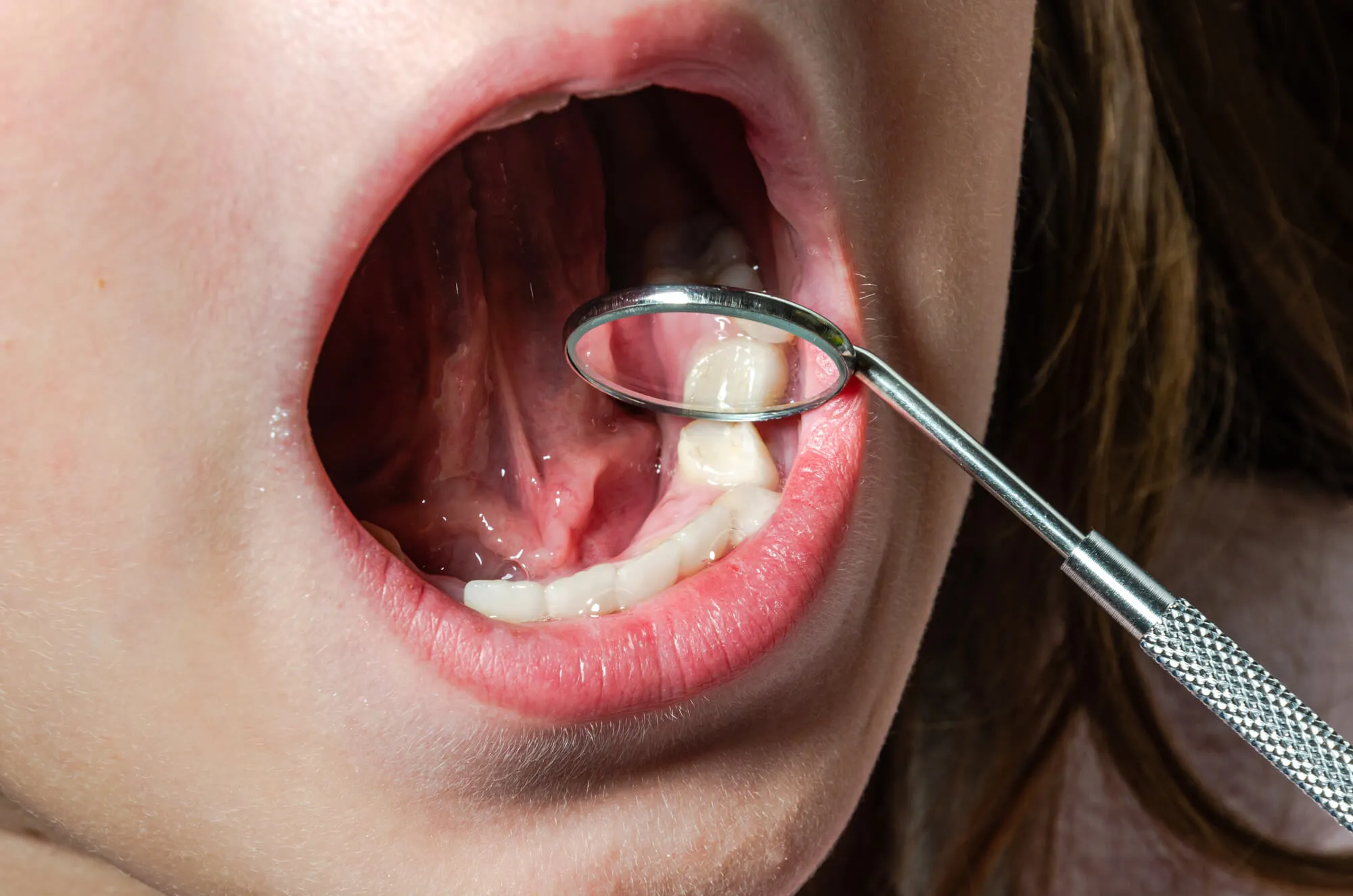Pediatric dentist performing oral exam