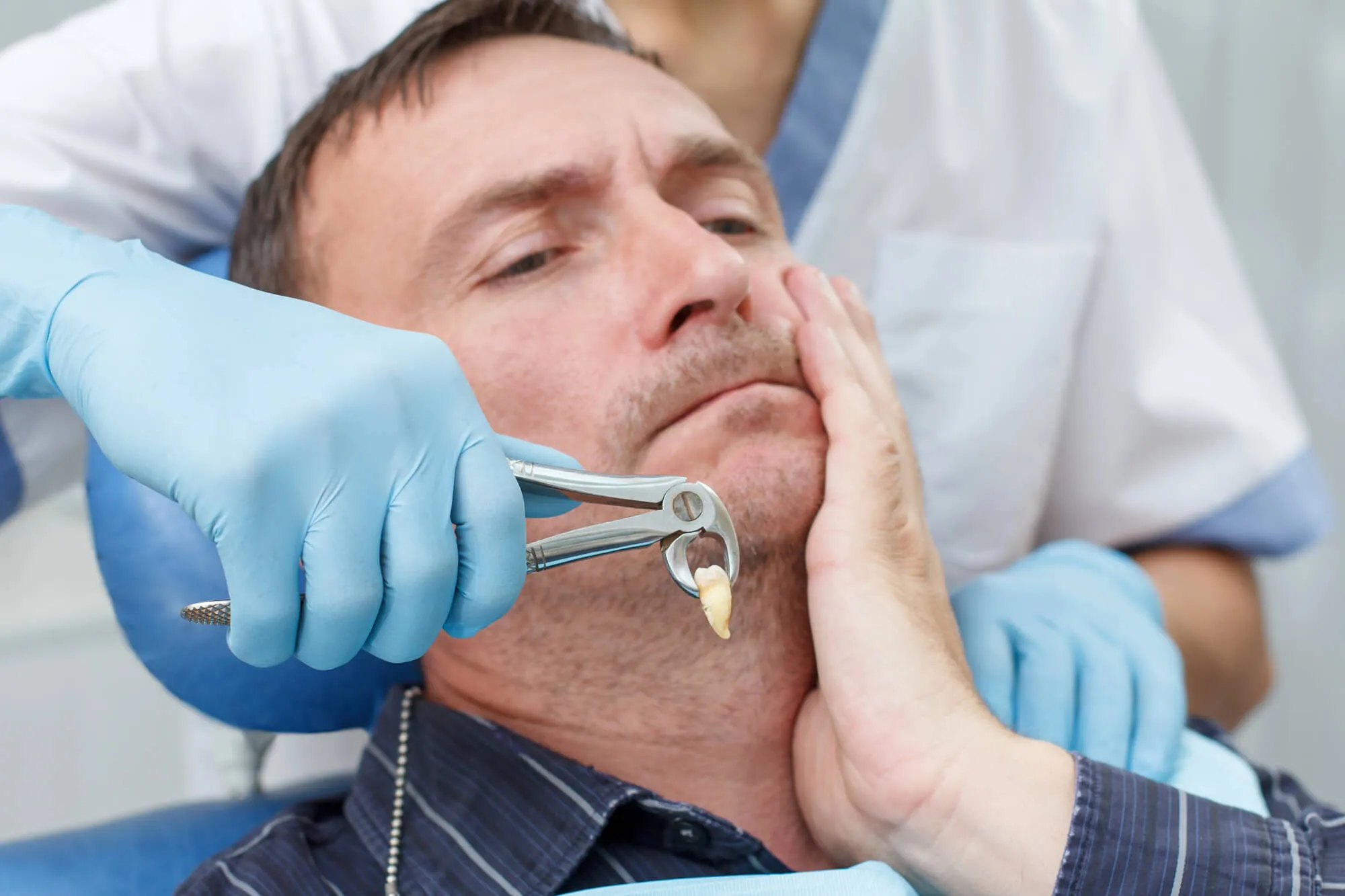 post Tooth extractions Marietta