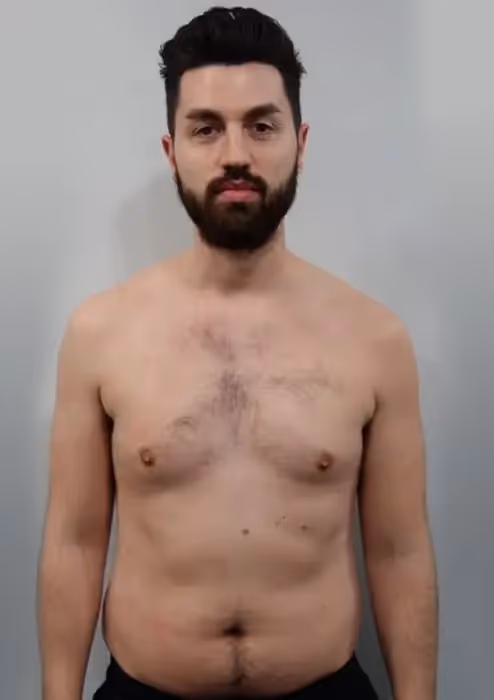 Before transformation