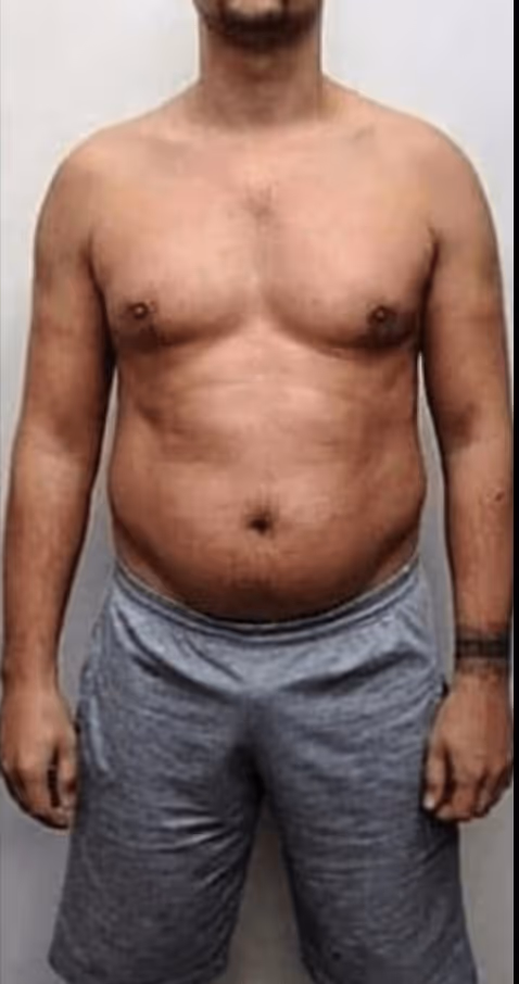 Before transformation