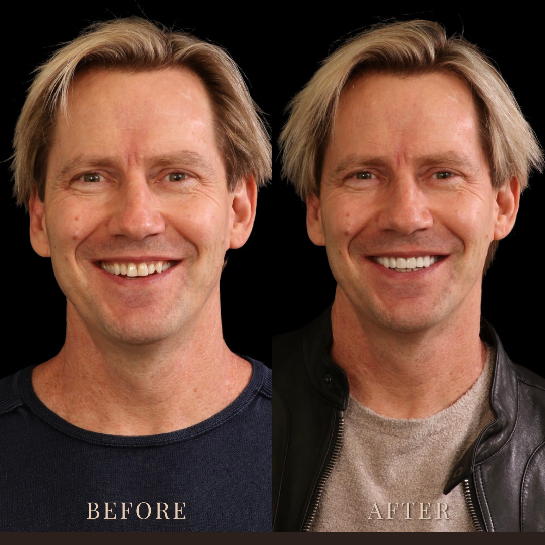 After Image