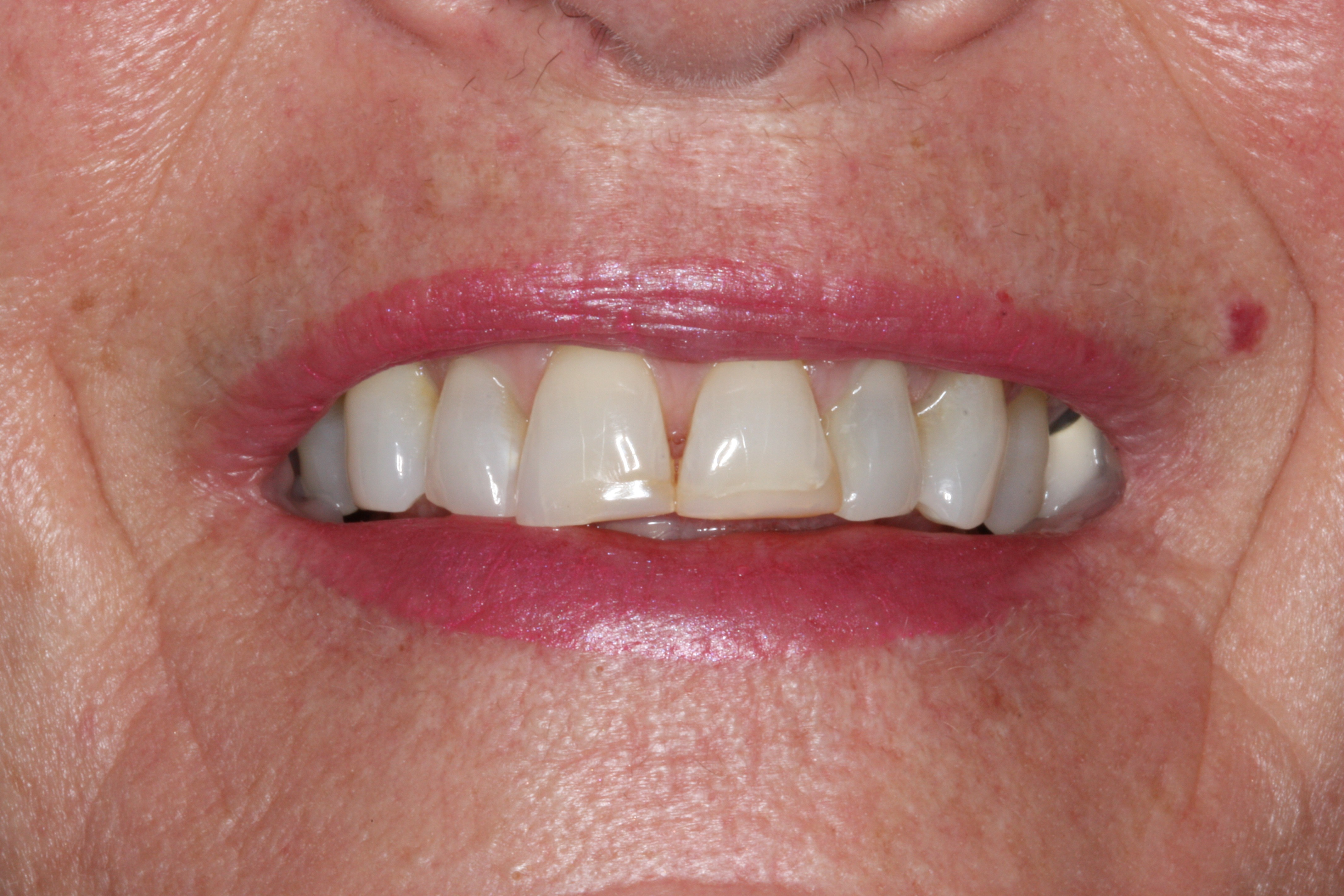 Before Image